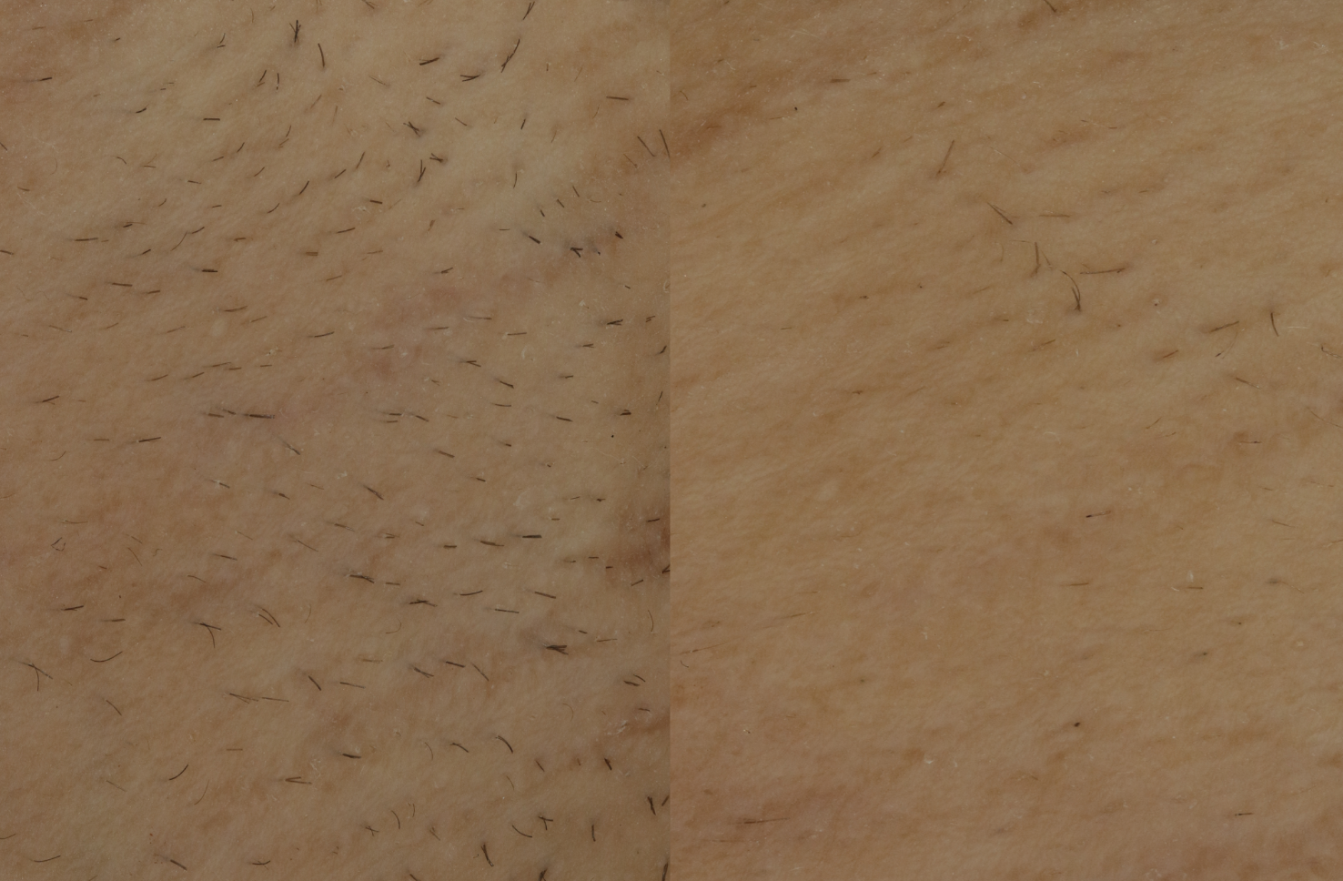 Before and after our Mini Lite