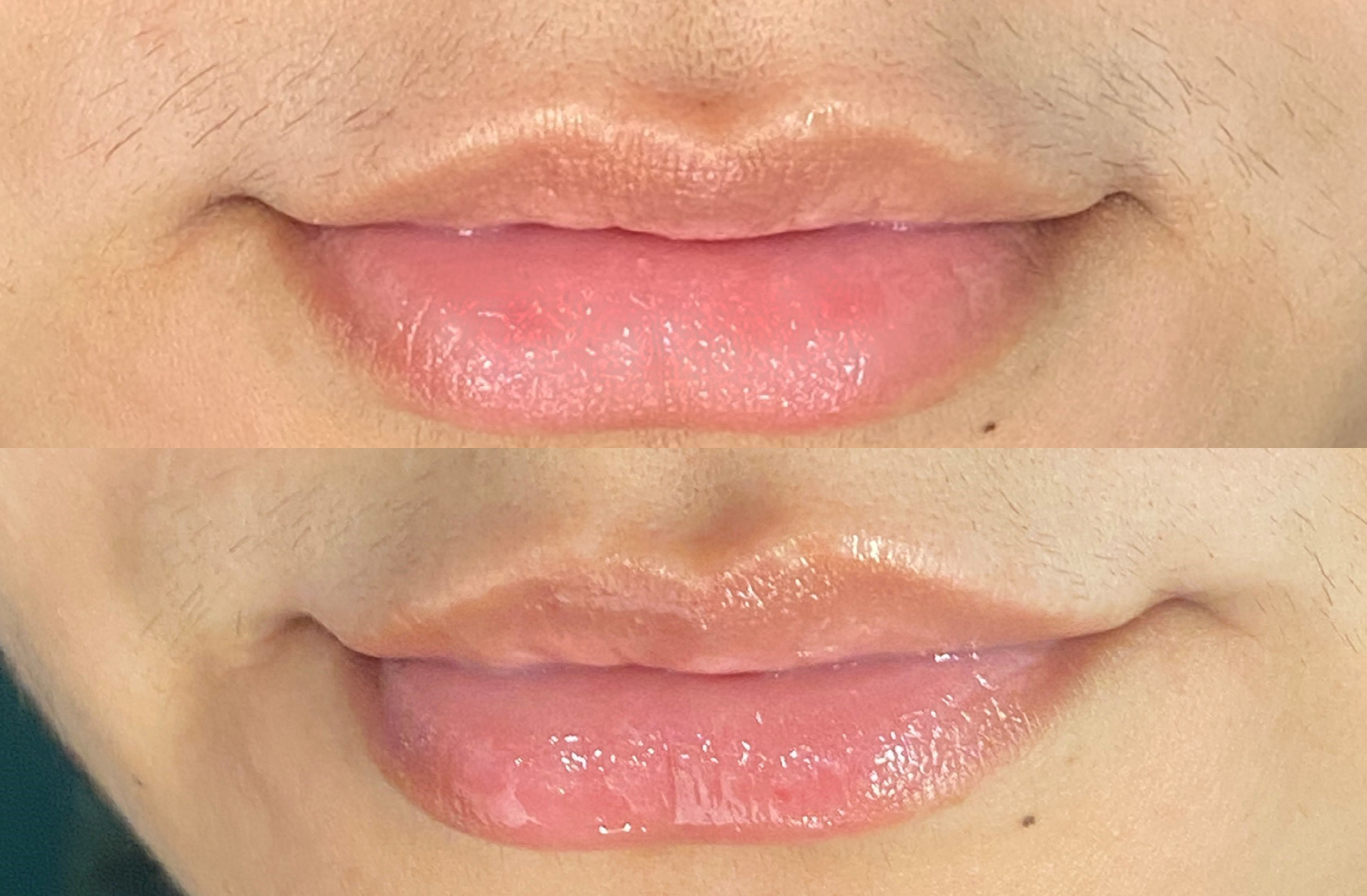 Before and after our Mini Lite